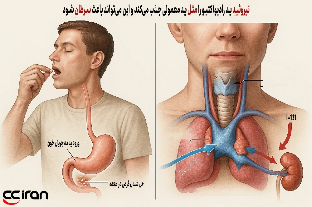 نحوه عملکرد غده تیروئید در برابر تشعشعات هسته ای